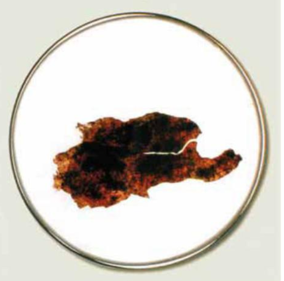 Hostia premenená na telo v roku 1992